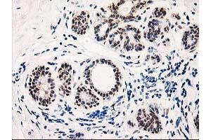 Immunohistochemical staining of paraffin-embedded Human breast tissue using anti-TP53I3 mouse monoclonal antibody. (TP53I3 anticorps)