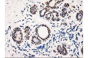 Immunohistochemical staining of paraffin-embedded Human breast tissue using anti-TP53I3 mouse monoclonal antibody.