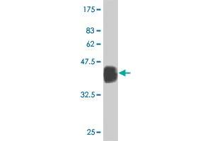 Western Blot detection against Immunogen (36. (TCD1A anticorps  (AA 173-272))