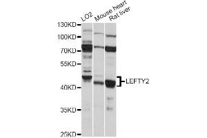 Western blot analysis of extracts of various cell lines, using LEFTY2 antibody (ABIN6292173) at 1:1000 dilution. (LEFTY2 anticorps)