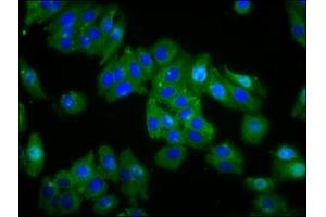 Immunofluorescence staining of HepG2 cells with ABIN7159174 at 1:66, counter-stained with DAPI. (OPN1MW anticorps  (AA 1-52))