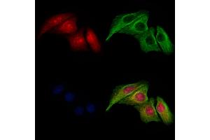 ABIN6265840 and ABIN6277615 staining Hela cells by IF/ICC. (UBD anticorps  (Internal Region))