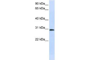 C6ORF21 antibody used at 1 ug/ml to detect target protein. (LY6G6F anticorps  (Middle Region))