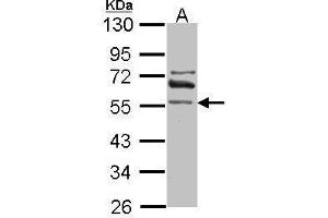 WB Image Sample (30 ug of whole cell lysate) A: IMR32 10% SDS PAGE antibody diluted at 1:1000 (ALDH1A2 anticorps)