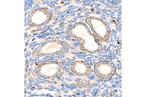 Immunohistochemistry analysis of paraffin-embedded mouse uterus using,Arp2 (ABIN7072895) at dilution of 1: 1500 (ARPC1B anticorps)