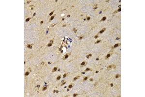 Immunohistochemistry of paraffin-embedded mouse brain using HMG20A antibody (ABIN5974388) at dilution of 1/100 (40x lens). (HMG20A anticorps)
