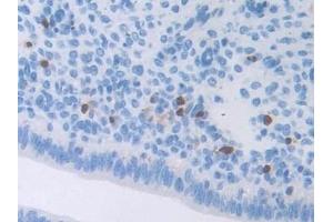 Detection of ATF6 in Mouse Uterus Tissue using Polyclonal Antibody to Activating Transcription Factor 6 (ATF6)