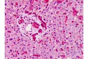 Human Liver: Formalin-Fixed, Paraffin-Embedded (FFPE)