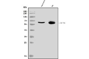 Western blot analysis of ARID5A using anti-ARID5A antibody (ABIN7602022).
