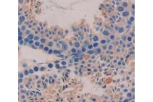 Figure. (CRISP2 anticorps  (AA 22-240))