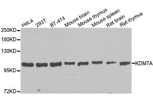 Western blot analysis of extracts of various cell lines, using KDM7A antibody. (JHDM1D anticorps  (AA 417-735))