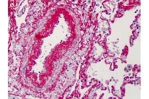 Anti-Elastin antibody IHC of human lung. (Elastin anticorps)