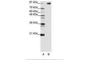 Image no. 2 for anti-Pre-mRNA Branch Site Protein p14 (SF3B14) (AA 90-139) antibody (ABIN203256) (Pre-mRNA Branch Site Protein p14 (SF3B14) (AA 90-139) anticorps)