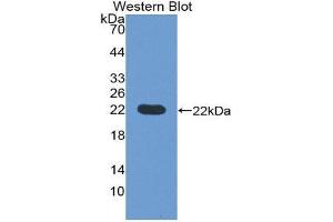 Western Blotting (WB) image for anti-Prepronociceptin (PNOC) (AA 20-176) antibody (ABIN1176128) (PNOC anticorps  (AA 20-176))