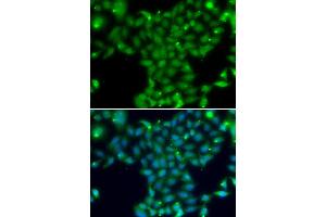 Immunofluorescence analysis of U20S cell using TGM5 antibody. (Transglutaminase 5 anticorps)