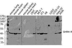 Western Blot (WB) analysis of specific lysis using GHRH-R Polyclonal Antibody. (GHRHR anticorps  (C-Term))