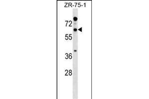 RTN2 Antibody (N-term) (ABIN1538959 and ABIN2849101) western blot analysis in ZR-75-1 cell line lysates (35 μg/lane). (Reticulon 2 anticorps  (N-Term))