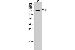 Western Blotting (WB) image for anti-Follicle Stimulating Hormone Receptor (FSHR) (Internal Region) antibody (ABIN3184700) (FSHR anticorps  (Internal Region))