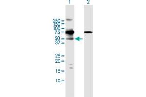 Western Blot analysis of RIOK3 expression in transfected 293T cell line by RIOK3 MaxPab polyclonal antibody. (RIOK3 anticorps  (AA 1-519))