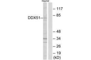 Western blot analysis of extracts from HepG2 cells, using DDX51 antibody. (DDX51 anticorps  (C-Term))