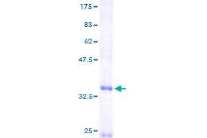 Image no. 1 for Chemokine (C-X-C Motif) Ligand 14 (CXCL14) (AA 1-111) protein (GST tag) (ABIN1350818)