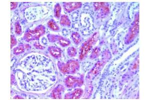 Immunohistochemical analysis of Human L-FABP in Paraffin Embedded Human kidney tissue using FABP1 Antibody Cat.