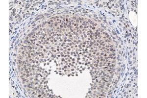 ABIN6264195 and ABIN6266861 at 1/100 staining Rat ovarian tissue by IHC-P. (PIAS1 anticorps  (N-Term))