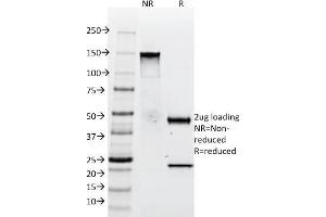 SDS-PAGE Analysis Purified Tenascin C Mouse Monoclonal Antibody (SPM319).