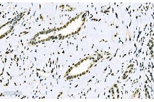 IHC analysis of splicing factor 1 using anti-splicing factor 1 antibody (ABIN7600193). (Splicing Factor 1 anticorps  (AA 160-266))
