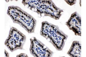 Visfatin was detected in paraffin-embedded sections of mouse intestine tissues using rabbit anti- Visfatin Antigen Affinity purified polyclonal antibody (Catalog # ) at 1 µg/mL. (NAMPT anticorps  (AA 62-337))