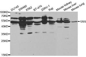 Western blot analysis of extracts of various cell lines, using GSS antibody. (Glutathione Synthetase anticorps  (AA 1-474))