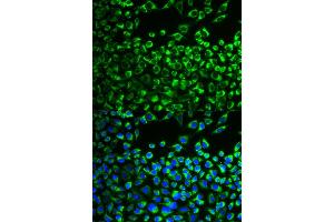 Immunofluorescence analysis of MCF-7 cells using CYP51A1 antibody (ABIN6292369).
