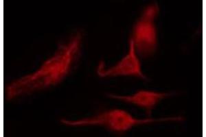 ABIN6268988 staining NIH-3T3 by IF/ICC. (HNRNPK anticorps  (pSer284))