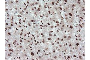 Image no. 6 for anti-Tripartite Motif Containing 38 (TRIM38) (AA 1-265) antibody (ABIN1490681) (TRIM38 anticorps  (AA 1-265))