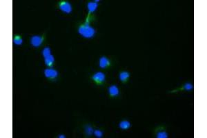Image no. 4 for anti-Trafficking Protein Particle Complex 4 (TRAPPC4) antibody (ABIN1501264) (TRAPPC4 anticorps)