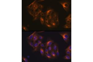 Immunofluorescence analysis of U-2 OS cells using Tubulin beta-1 chain Rabbit mAb (ABIN7271045) at dilution of 1:100 (40x lens).