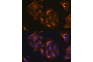 Immunofluorescence analysis of U-2 OS cells using Tubulin beta-1 chain Rabbit mAb (ABIN7271045) at dilution of 1:100 (40x lens). (TUBB1 anticorps)