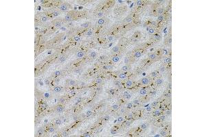 Immunohistochemistry of paraffin-embedded human liver injury using MAPK1 antibody (ABIN5998180) at dilution of 1/100 (40x lens).