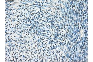 Immunohistochemical staining of paraffin-embedded Ovary tissue using anti-PPP5Cmouse monoclonal antibody. (PP5 anticorps)