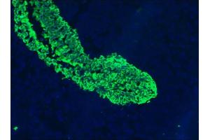 Image no. 3 for anti-Keratin 5/8 (KRT5/8) antibody (ABIN335325) (Keratin 5/8 anticorps)