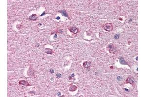 Immunohistochemistry (IHC) image for anti-Calcium/calmodulin-Dependent Protein Kinase II beta (CAMK2B) (AA 1-504) antibody (ABIN614553)