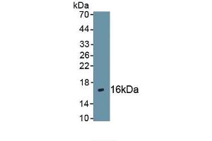 Detection of Recombinant CXCR4, Human using Polyclonal Antibody to Chemokine C-X-C-Motif Receptor 4 (CXCR4) (CXCR4 anticorps  (AA 262-352))