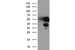 Western Blotting (WB) image for anti-T-Cell Acute Lymphocytic Leukemia 1 (TAL1) antibody (ABIN1501288) (TAL1 anticorps)
