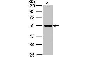 WB Image Sample (30 ug of whole cell lysate) A: Molt-4 , 10 % SDS PAGE antibody diluted at 1:1000 (PSKH1 anticorps)