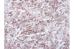IHC-P Image Immunohistochemical analysis of paraffin-embedded SW480 xenograft, using Frizzled 8, antibody at 1:100 dilution. (FZD8 anticorps  (C-Term))