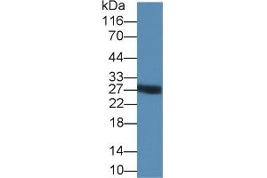Detection of TRY in PANC1 cell lysate using Polyclonal Antibody to Trypsin (TRY) (Trypsin anticorps  (AA 9-231))