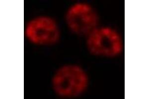 ABIN6277572 staining Hela cells by IF/ICC.