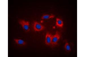 Immunofluorescent analysis of LATH staining in K562 cells. (LATH anticorps  (Center))