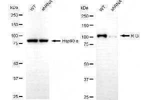 Western blotting analysis using RIGI antibody (ABIN7800966).