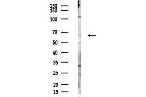 Western blot analysis of lysates from Hela cells(heat-shock,45 min treatment), using BIN1 Antibody at 1/1000 dilution.